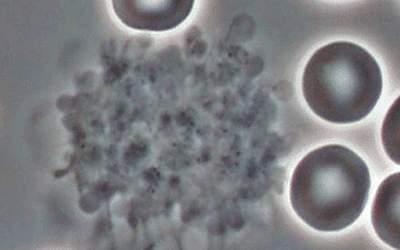 Platelet-Aggregation