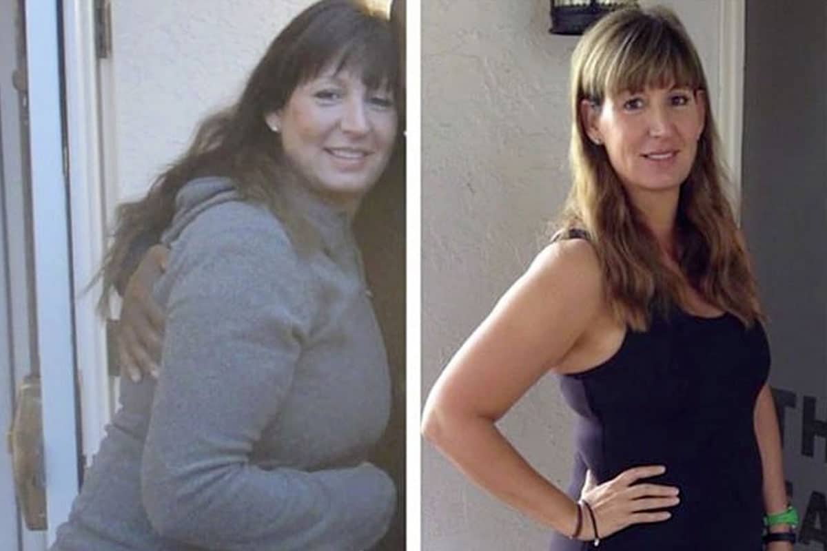 woman posing to show before and after weight loss journey